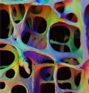 Ostéoporose : bien manger est essentiel à la santé de vos os