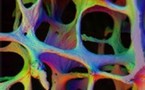 Ostéoporose : bien manger est essentiel à la santé de vos os
