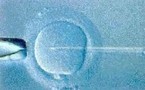 Bioéthique : ce que veulent les Français